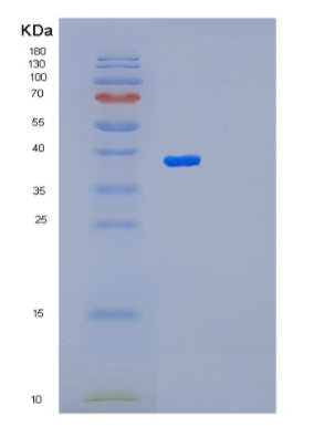 Recombinant Human PAX9 Protein