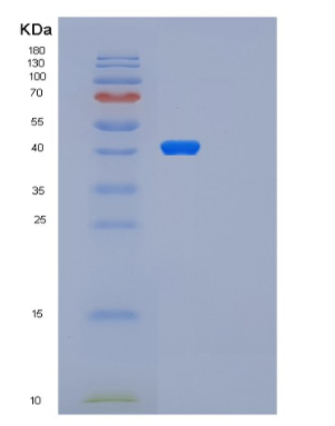 Recombinant Human PARP2 Protein