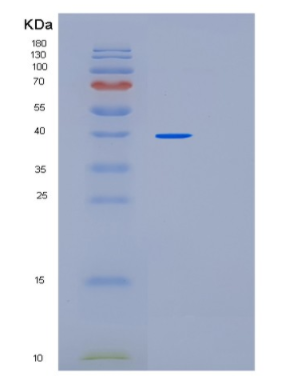 Recombinant Human PARP1 Protein