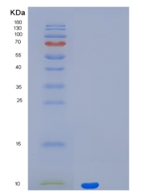 Recombinant Parathyroid Hormone Protein