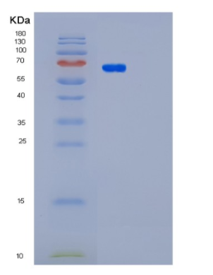Recombinant Human PAK4 Protein