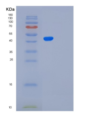 Recombinant Human PAFAH2 Protein