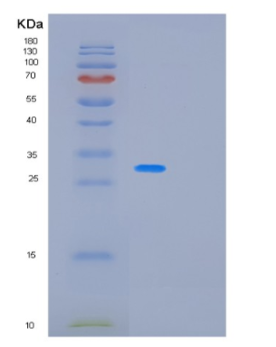 Recombinant Human PAFAH1B3 Protein