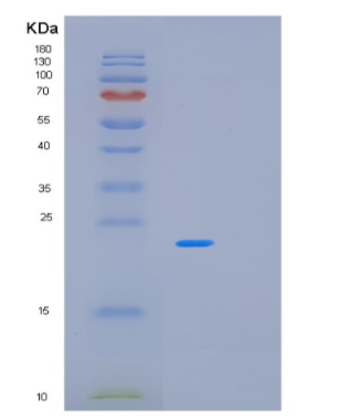 Recombinant Human PAEP Protein