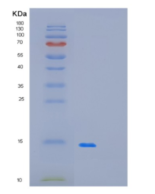 Recombinant Human OLFM1 Protein