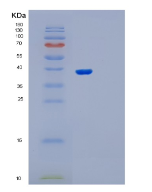 Recombinant Human OSGEP Protein