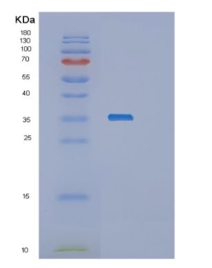 Recombinant Human Osteopontin Protein