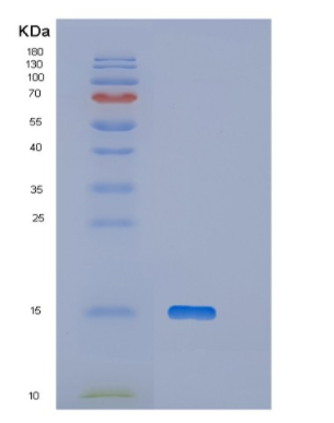 Recombinant Human OTOR Protein