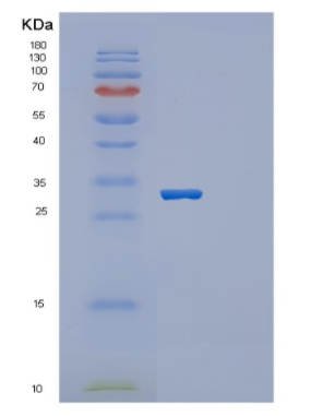 Recombinant Human Otubain 1 Protein