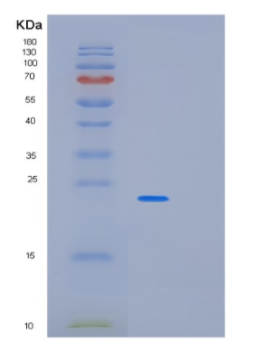 Recombinant Human PABPN1 Protein