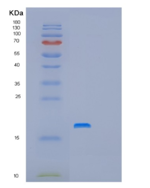 Recombinant Human PFDN4 Protein