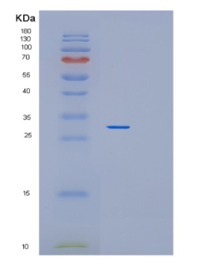 Recombinant Human PEX26 Protein