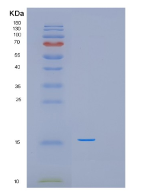 Recombinant Human PFDN6 Protein