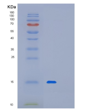 Recombinant Human PFDN1 Protein