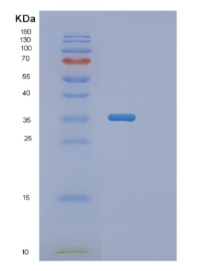 Recombinant Human PGP Protein