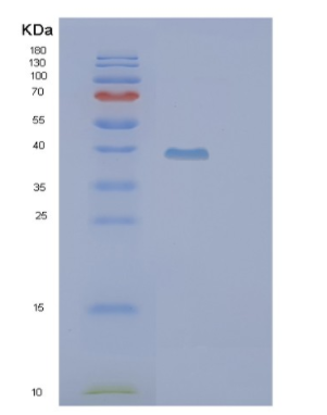 Recombinant Human PIH1D2 Protein