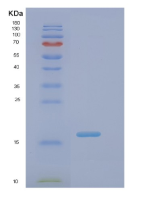 Recombinant Human Pin 1(Peptidyl-prolyl cis/trans isomerase) Human Protein