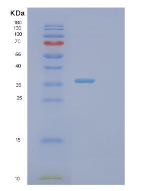Recombinant Human PINK1 Protein