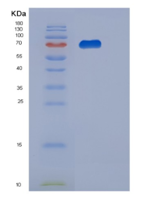 Recombinant Human PGM2 Protein