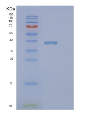 Recombinant Human PINX1 Protein