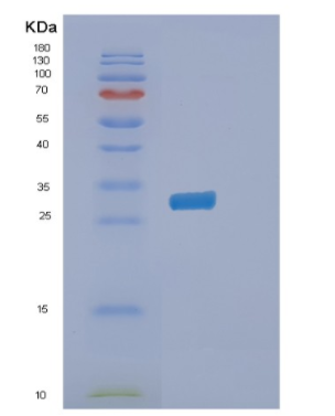 Recombinant Human PITPNB Protein