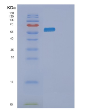 Recombinant Human PKLR Protein