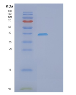 Recombinant Human PHF11 Protein