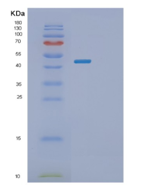Recombinant Human PLA2G7 Protein