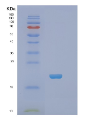 Recombinant Human PHLDA2 Protein