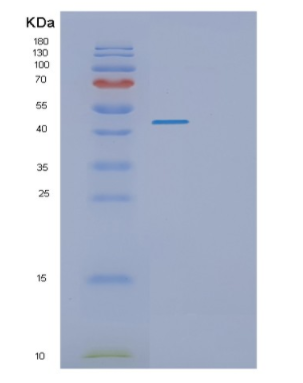 Recombinant Human PKNOX1 Protein