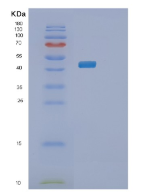 Recombinant Human PLA1A Protein
