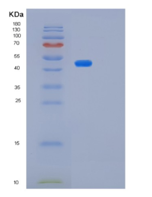 Recombinant Human PLAU Protein