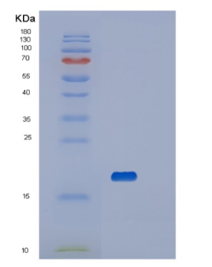 Recombinant Human Platelet receptor Gi24 Protein