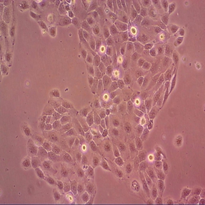 BHT101人甲状腺癌细胞