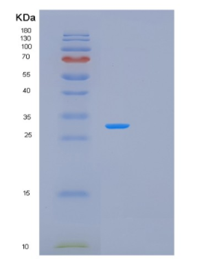 Recombinant Human PLAUR Protein