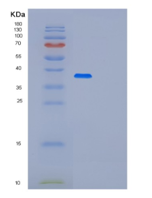 Recombinant Human PLCXD3 Protein