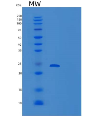 Recombinant Human PMVK Protein