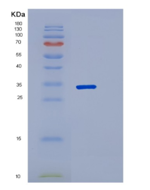 Recombinant Human PNP Protein