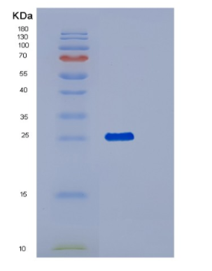 Recombinant Human PNPO Protein