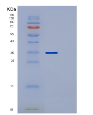 Recombinant Human POLR2C Protein