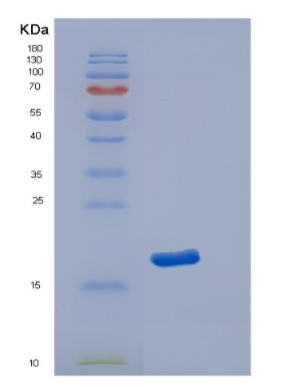 Recombinant Human POLR2D Protein
