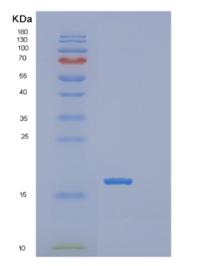 Recombinant Human POLR2I Protein