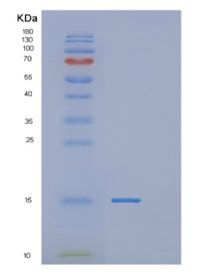 Recombinant Human POLR2J Protein