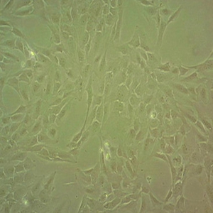 MOLT-3人淋巴细胞白血病细胞