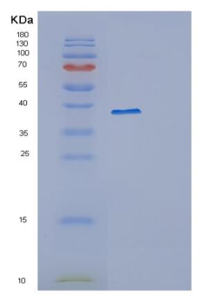 Recombinant Human PPP1R8 Protein