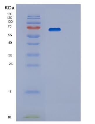 Recombinant Human PPP2R1A Protein