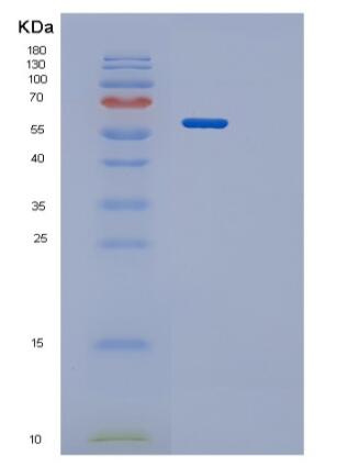 Recombinant Human PPP3CA Protein