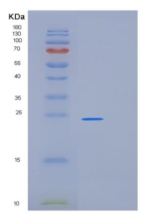 Recombinant Human PRDX1 Protein