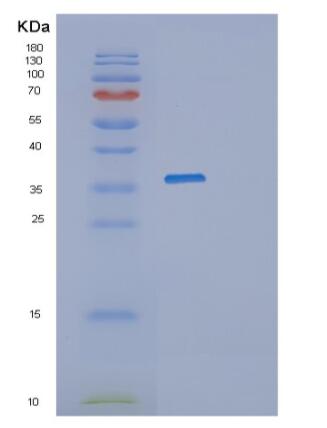 Recombinant Human PRKRA Protein