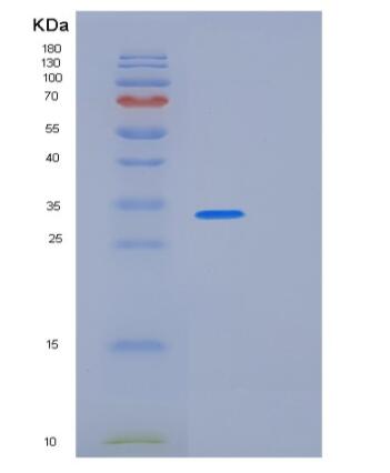 Recombinant Human PQBP1 Protein